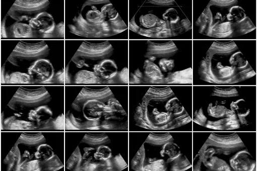 Growth Scan